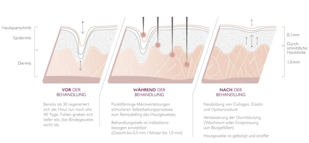 kosmetik Gärtringen